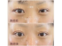 リリハ(Liliha)の雰囲気（【アイパワーエステ】目元悩みに特化したケアで5年10年先も綺麗!）