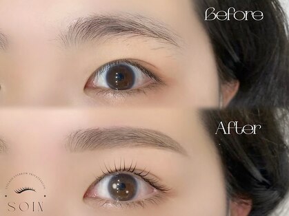ソワン(SOIN)の写真