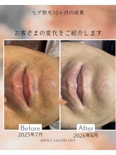 オフ(off)/ヒゲ脱毛