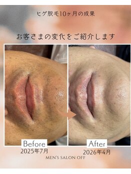 オフ(off)/ヒゲ脱毛