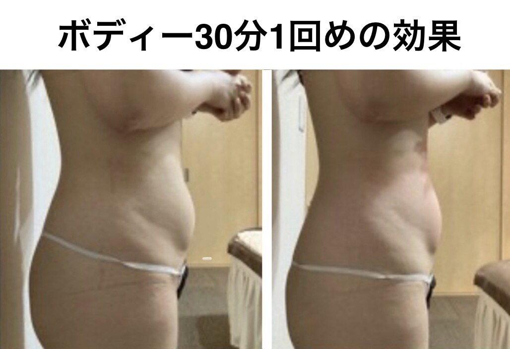 ❤エステサロン最新最先端モデル❣有効成分を皮膚の深部に深く浸透拡散♪❤美顔器 サーマトリックス 名古屋に関するエステサロン 【医療提携】肌質改善