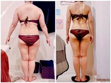 パーフェクトボディプレミアム 天王寺店(PERFECT BODY PREMIUM)/お客様　ビフォーアフター（24）