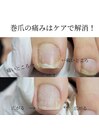 巻爪解消!+ケア!¥5500