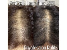 ルチル(Rutile)/プロセルセラピーズ