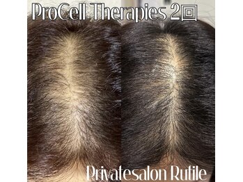 ルチル(Rutile)/プロセルセラピーズ