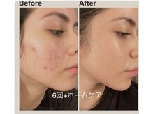 ツナミ(Tsunami)/今月のキャンペーン