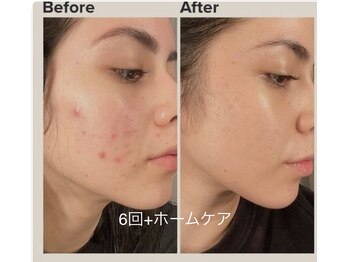 ツナミ(Tsunami)/今月のキャンペーン