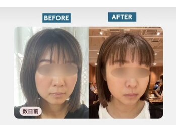 ラ ヴィ リッシュ(La vie riche)/初facia体験!お腹は必ずセット