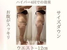 フォーユー マシバメディカル(For You Mashiba Medical)の雰囲気（最後のダイエット！！あったかマシーンでマイナス１０センチ）