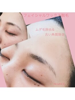 ニュアンス(nuance)/フェイシャル脱毛