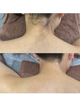 エンジェルワックス 新宿店(Angel Wax)/なりたい理想の首元へ