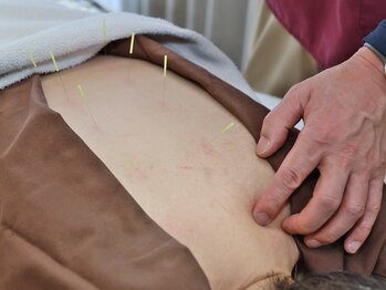 平和通りいわお鍼灸院/