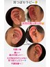 耳つぼジュエリー(セラピー)マッサージ付き