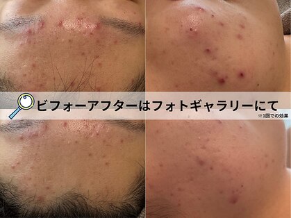 ラニ(Lani)の写真