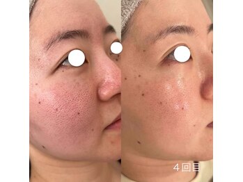 ランポ(lampo)/Lit 4回目