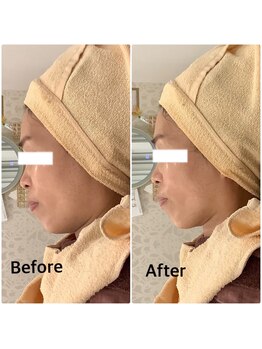 スペチアーレ 夙川/抜群のリフトアップ