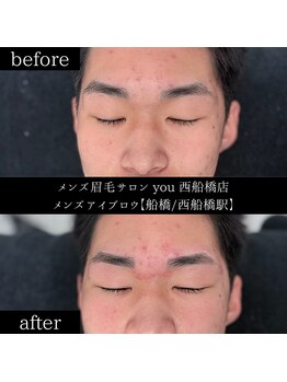 ユー 西船橋店(you)/ビフォーアフターお写真