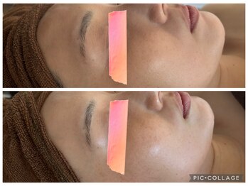 イディアル(IDE'AL)/ハーブ＋塗るボト＋生酵素