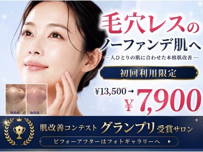 デアマリスの写真