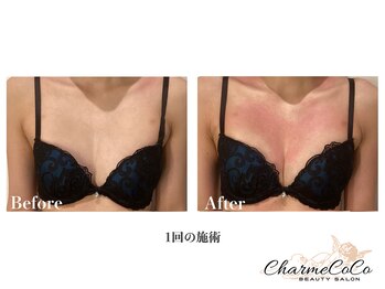 シャルムココ 蔵前店(CharmeCoCo)/お客様Before→After