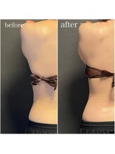 ミミ(MIMI)/【ダイエット】背中すっきり