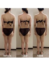 オンディーヌ 名古屋/劇的に!!エステ通いは短期に卒業