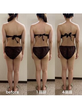 オンディーヌ 名古屋/劇的に!!エステ通いは短期に卒業