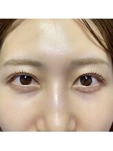 マニス(MANIS)/まつ毛パーマ（ラッシュリフト）