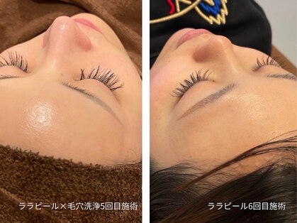 ライフ美容整体院 恵比寿(Life美容整体院)の写真