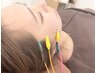 最終日！【U24学割】美容鍼はじめて体験◎垢抜け＆肌荒れケアに♪