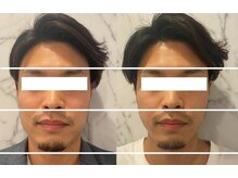 メディボーテサロン(MEDI BEAUTE SALON)/世界初最新機器を使用！