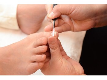 テテ(tete)の写真/【痛みを解消し、ストレスフリーな爪へ】固くなった角質/トラブル爪/巻き爪を丁寧にケアして整える☆