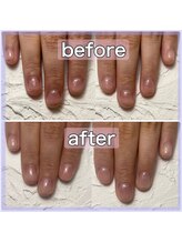 マッシュ MACHELA店(MASHU)/MISA 自爪育成