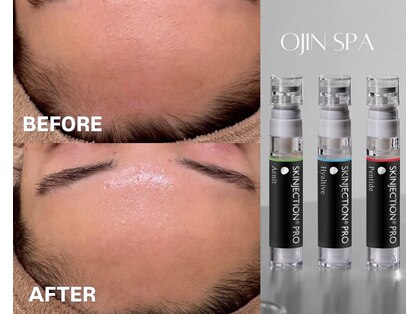 オージン スパ(OJIN SPA)の写真