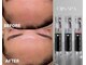オージン スパ(OJIN SPA)の写真
