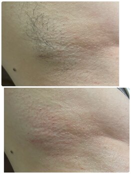 エン(en.)/BeforeAfter写真11