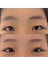 美眉アンド美肌専門サロンすみれ/フィフォーアフター