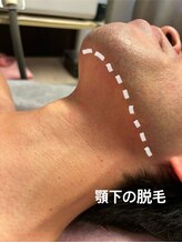 ゼロミリメートル(0mm)/【脱毛】ビフォーアフター