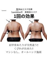 ラエッセス(A Laessess)/オバ見え？