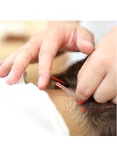 はぴねす鍼灸整骨院 西宮院 2号店/施術風景です