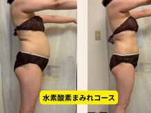 ヨサパーク カノン 湘南台店(YOSA PARK Kanon)の雰囲気（2ヶ月で-10kgの実績も！アットホームな女性限定の隠れ家サロン♪）