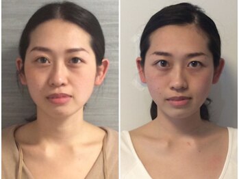 美容整体ウェリナ 中川八田院/小顔矯正/骨盤矯正/痩身整体