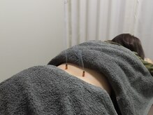 エバーグリーン(EVERGREEN)