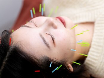 望鍼灸院/リフトアップ美容鍼