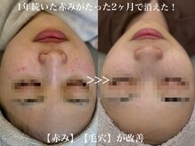 フィー(Fee)の雰囲気（本気を出せば素早く結果が出る！）