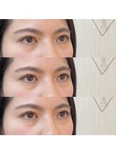 シアミス(SIAMIHS)/まつげパーマ