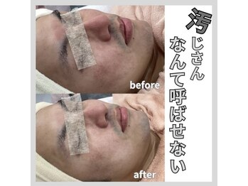 じゅえる/メンズエステも大好評 次へ→