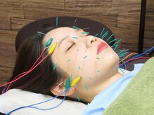 わきさか鍼灸整骨院・鍼灸院 レーヴ(Reve)の雰囲気（体験した人だけが実感できるワンランク上の美容鍼♪）