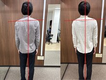 ルピナス整体院/姿勢ビフォーアフター