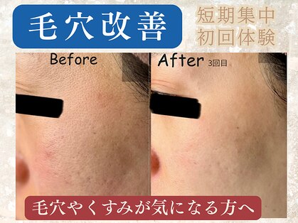 ハス(hasu.)の写真